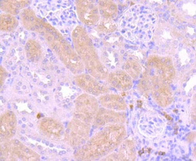 Anti-PIK3R1 Antibody (9O121)