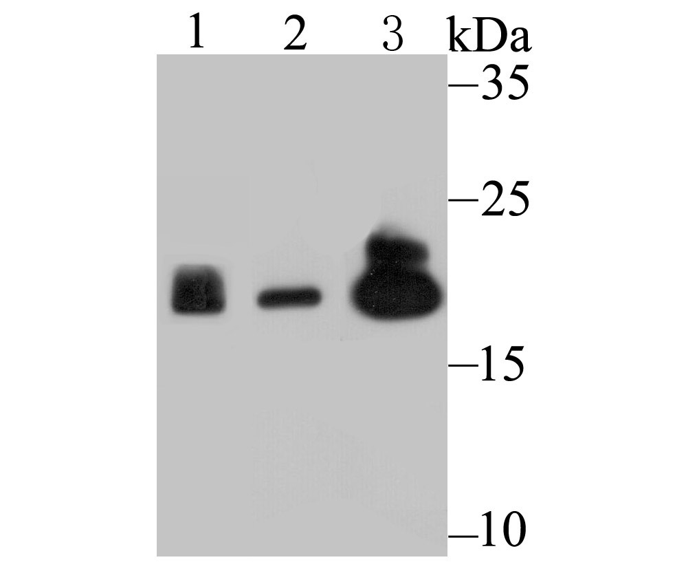 Anti-Proteasome 20S LMP2 Antibody (3S23)