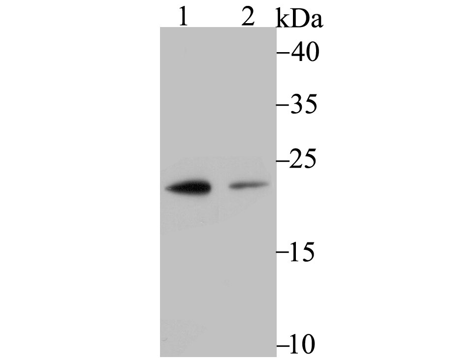 Anti-PSMB8 Antibody (3I410)