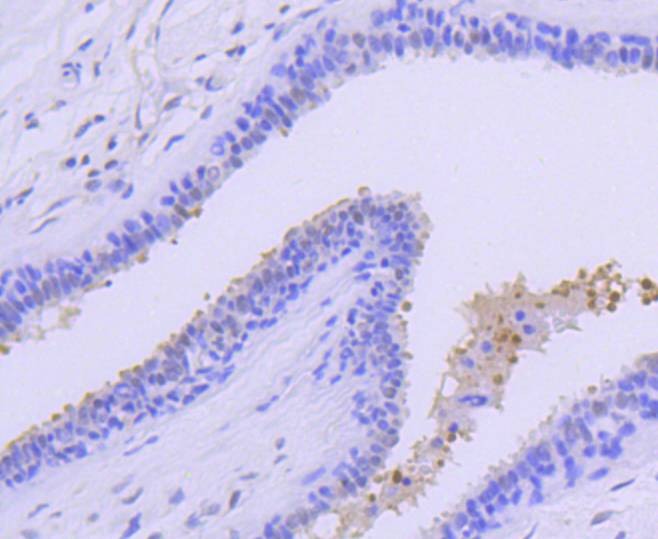 Anti-PRMT5 Antibody (3P436)