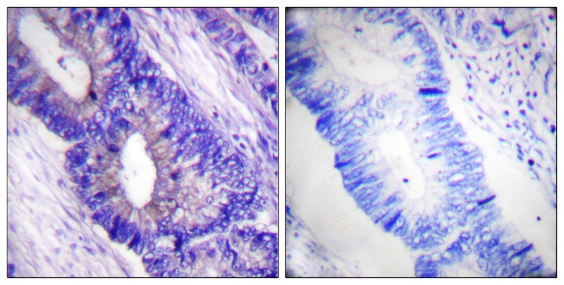 Anti-Phospho-PRKCA (Thr197) Polyclonal Antibody