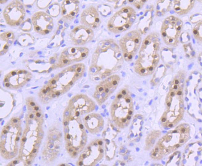 Anti-PRMT5 Antibody (3P436)
