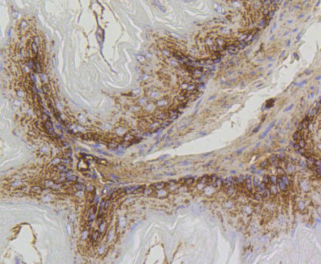 Anti-Prohibitin Antibody (1C561)