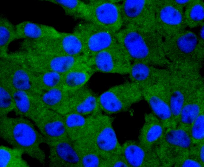 Anti-PRKCD Antibody (8E672)