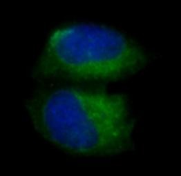 Anti-Caspase-3 Antibody (1F439)