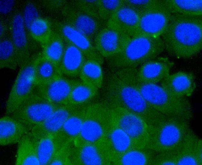 Anti-Prohibitin Antibody (1C561)