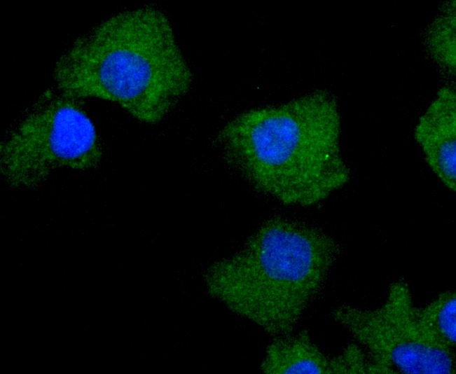Anti-PRKCD Antibody (8E672)