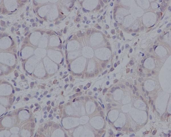 Anti-Caspase-3 Antibody (1F439)