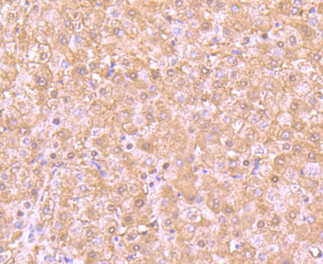 Anti-PSMB8 Antibody (3I410)