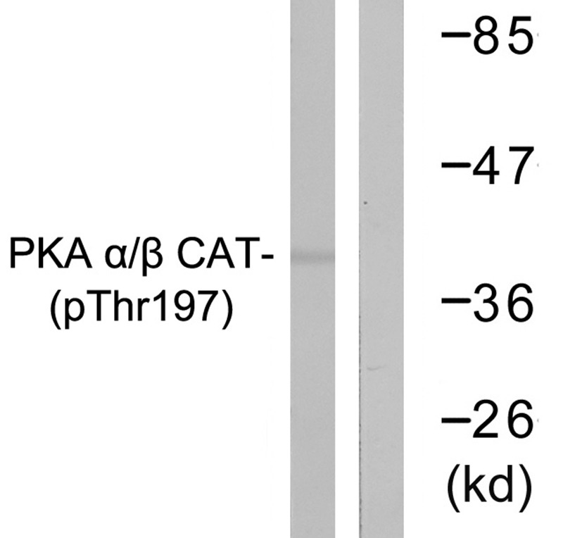 Anti-Phospho-PRKCA (Thr197) Polyclonal Antibody