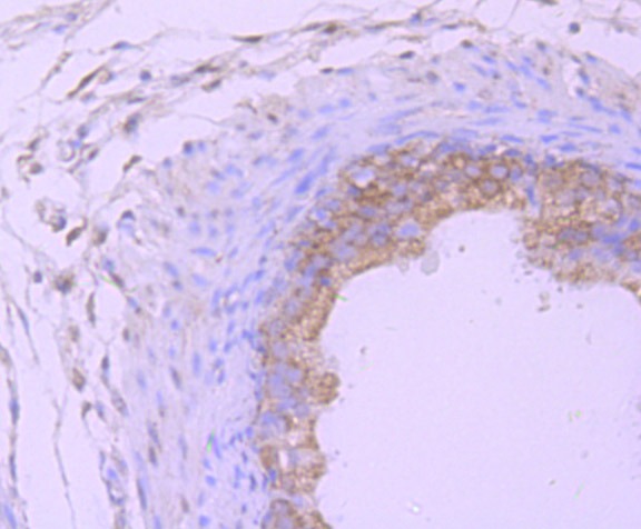 Anti-PSMB8 Antibody (3I410)