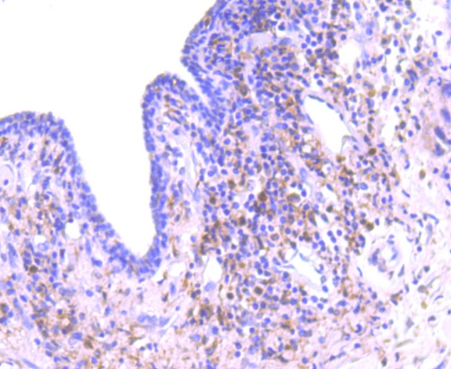 Anti-PRKCD Antibody (8E672)