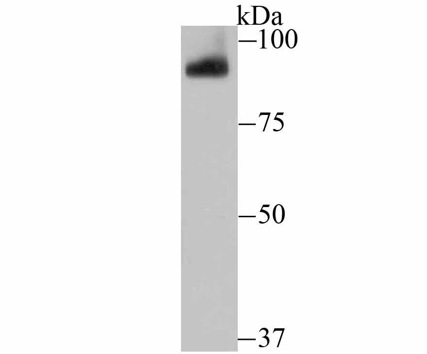 Anti-PIWIL1 Antibody (9H748)