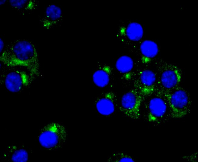 Anti-PKA 2 beta Antibody (8T490)