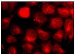 Anti-Phospho-PRKCA (Thr198) Polyclonal Antibody