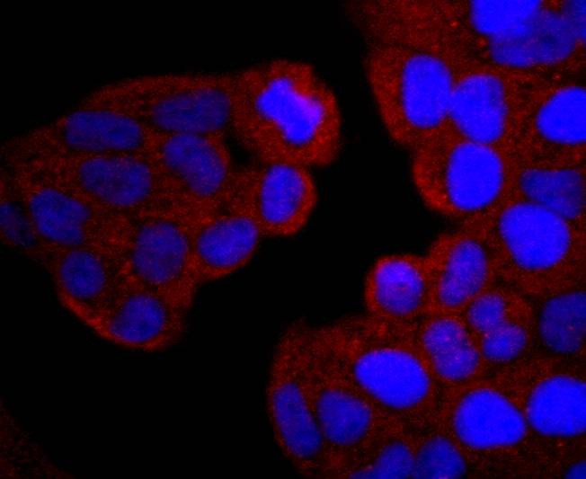 Anti-PIK3R1 Antibody (9O121)