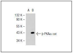 Anti-Phospho-PRKCA (Thr198) Polyclonal Antibody