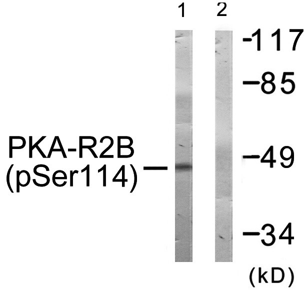 Anti-Phospho-PKA-R2β (Ser114) Polyclonal Antibody