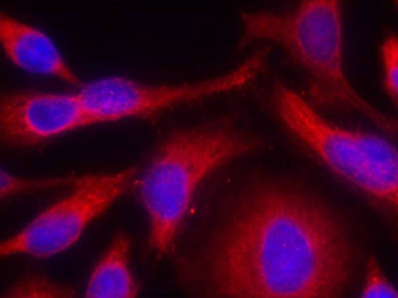 Anti-Phospho-PKD/PKCm (Ser738) Polyclonal Antibody