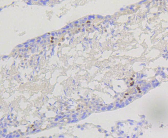 Anti-PI 3 Kinase p85 beta Antibody (9A867)