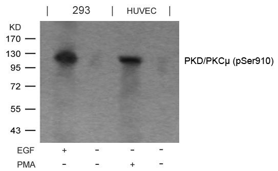 Anti-Phospho-PKD/PKCm (Ser910) Polyclonal Antibody 2