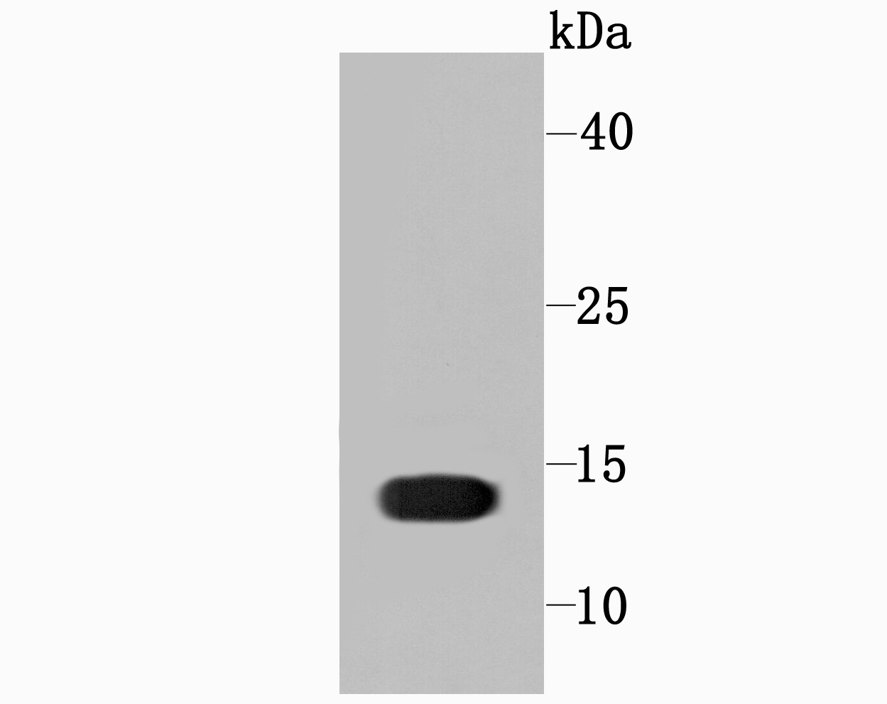 Anti-Profilin-1 Antibody (1I976)