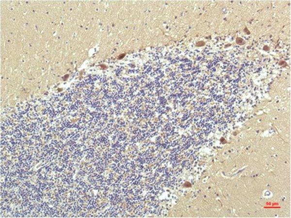 Anti-PPARD Antibody (2B812)