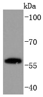 Anti-PPAR gamma/PPARG Antibody (2S691)