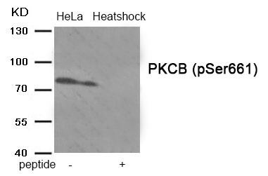 Anti-Phospho-PKC beta (Ser661) Polyclonal Antibody