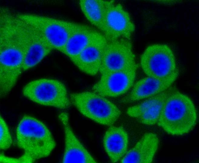 Anti-PRKCA Antibody (6S104)