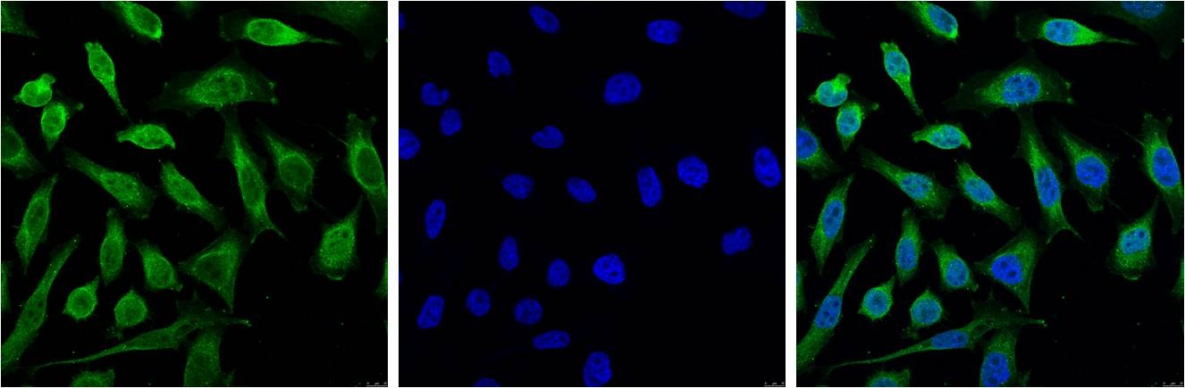 Anti-Progesterone Receptor Antibody (5S241)