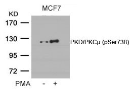 Anti-Phospho-PKD/PKCm (Ser738) Polyclonal Antibody