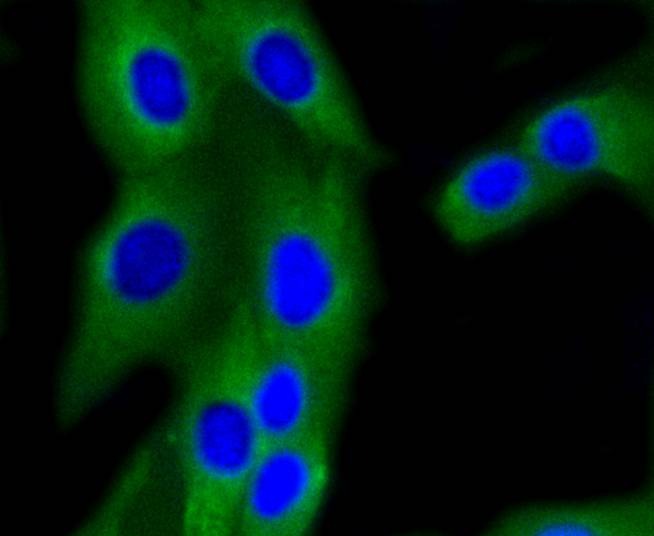 Anti-PI 3 Kinase p85 beta Antibody (9A867)
