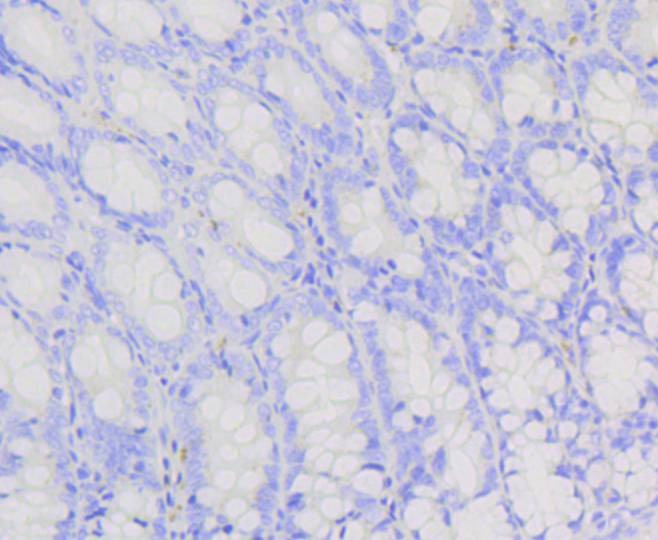 Anti-PI 3 Kinase p85 beta Antibody (9A867)