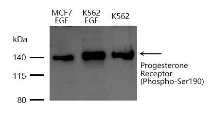 Anti-Phospho-Progesterone Receptor (Ser190) Polyclonal Antibody