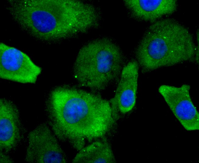 Anti-Profilin-1 Antibody (1I976)