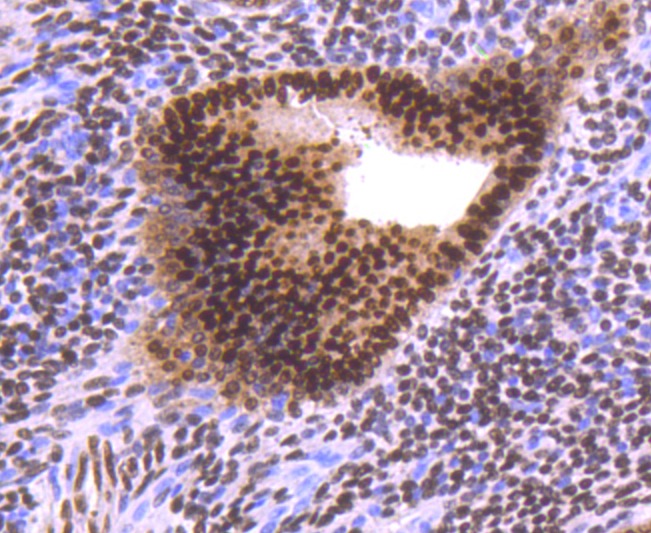 Anti-Progesterone Receptor Antibody (9Z37)