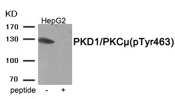 Anti-Phospho-PKD1/PKC μ (Tyr463) Polyclonal Antibody