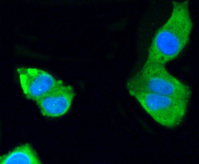 Anti-PRKCA Antibody (6S104)