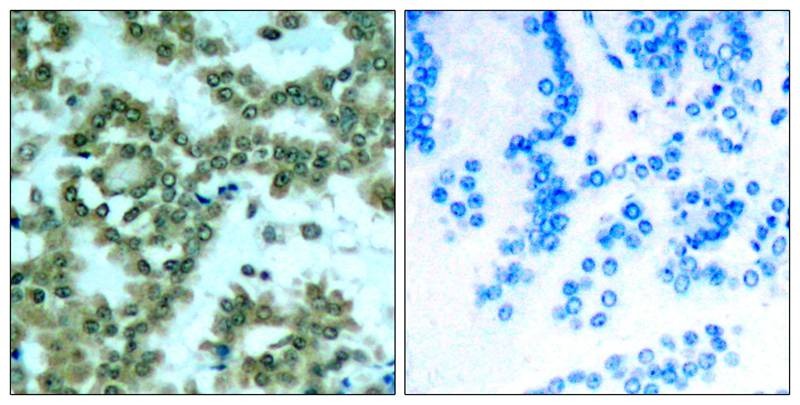 Anti-Phospho-PRKCQ (Ser676) Polyclonal Antibody