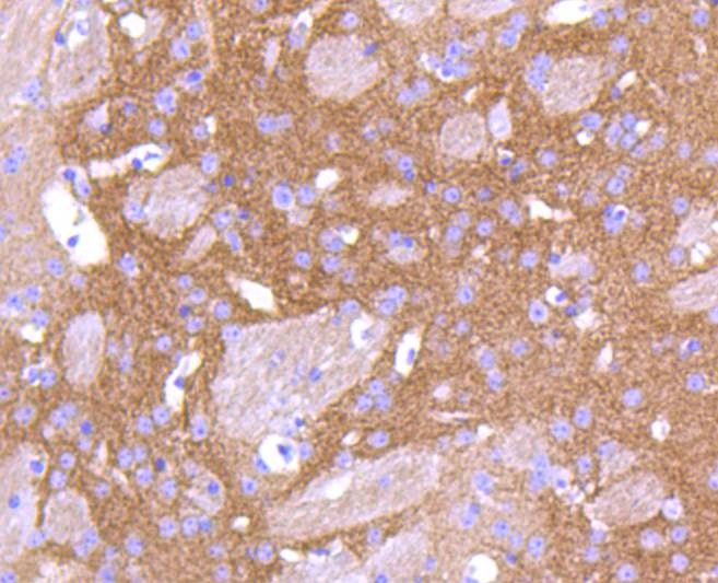 Anti-PKC beta Antibody (5T436)