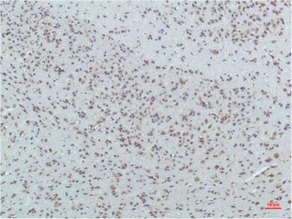 Anti-PPARD Antibody (2A714)