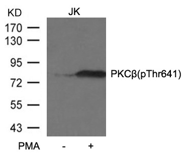 Anti-Phospho-PKC beta (Thr641) Polyclonal Antibody