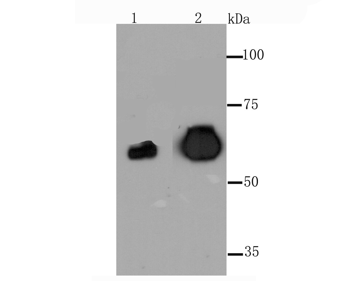 Anti-Alkaline Phosphatase (Placental type) /ALPP Antibody (8Z127)