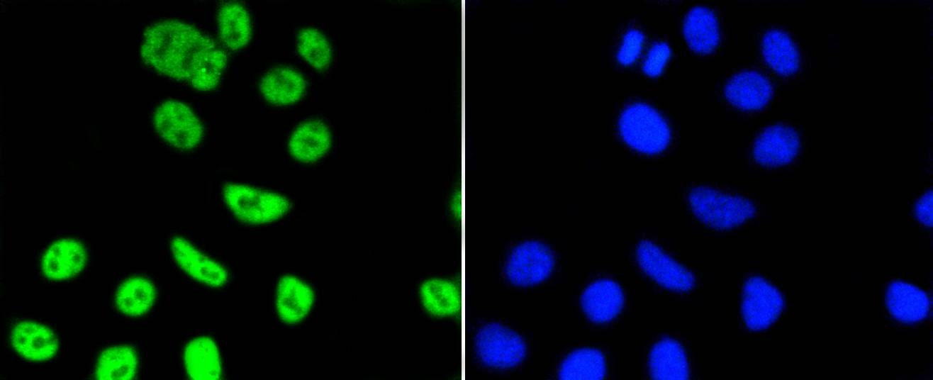 Anti-PIM1 Antibody (6F773)
