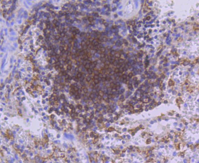 Anti-PKC beta Antibody (5T436)