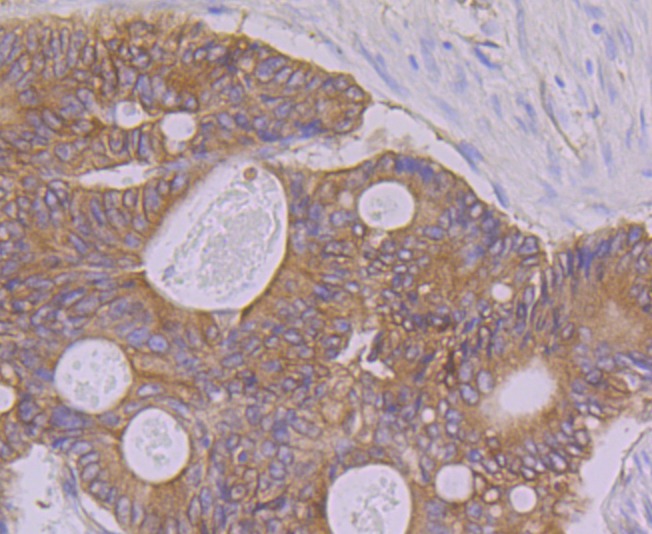 Anti-PON2 Antibody (3M227)
