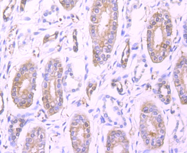 Anti-Profilin-1 Antibody (1I976)