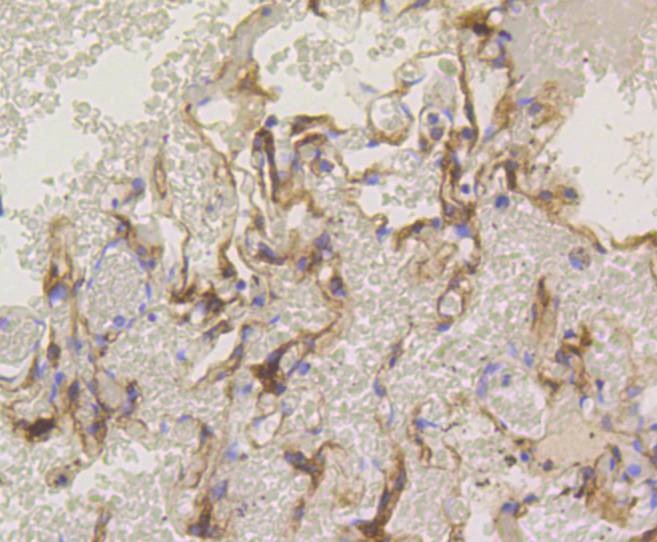 Anti-PRKCA Antibody (6S104)
