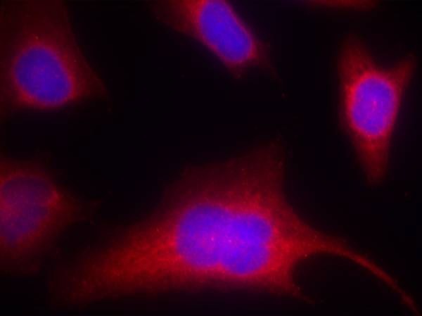 Anti-Phospho-PKD/PKCm (Ser910) Polyclonal Antibody 2